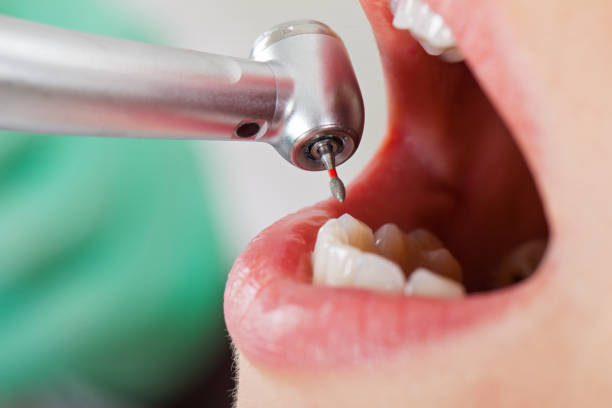 Best Tooth Pain Emergency Relief  in Rome City, IN